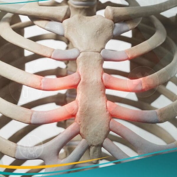 متلازمة تيتز (1)