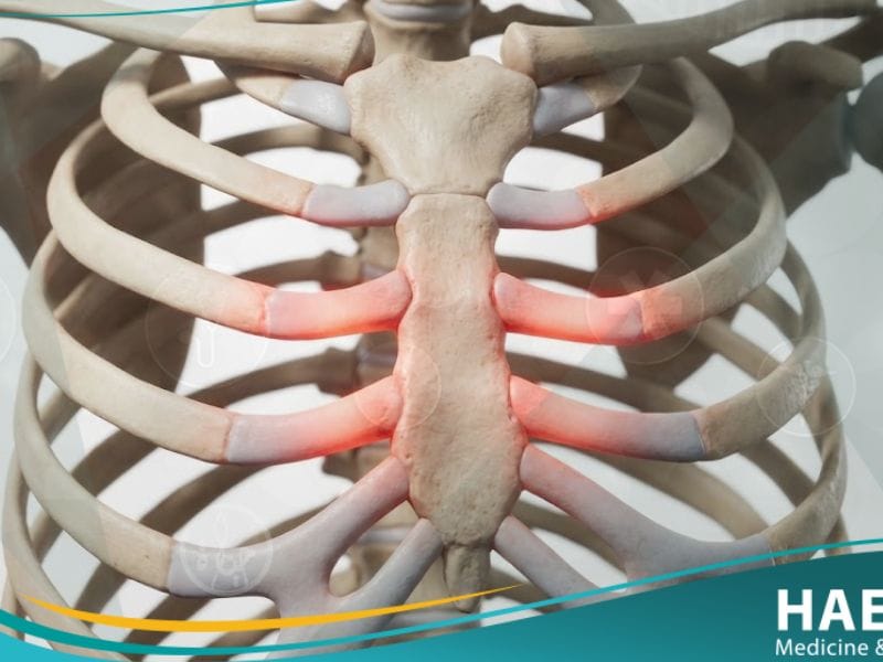 متلازمة تيتز (1)