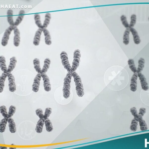 متلازمة تيرنير