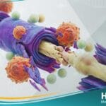 متلازمة جيلن باري