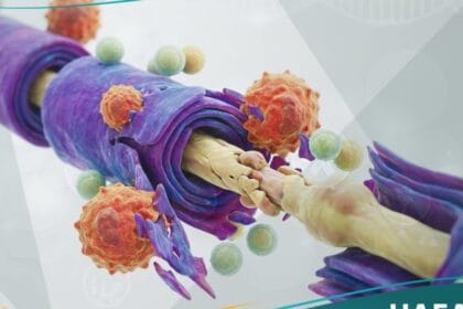 متلازمة جيلن باري