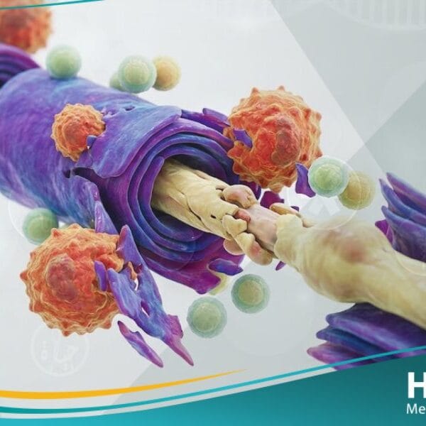 متلازمة جيلن باري