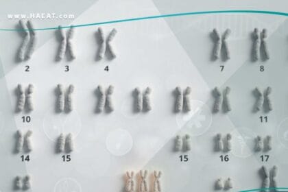 متلازمة داون