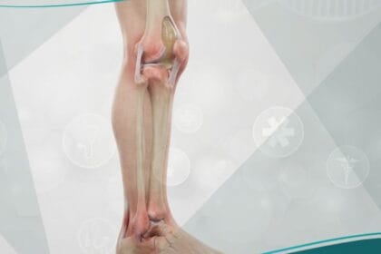 متلازمة رايتر (1)