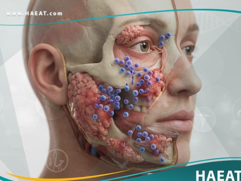 _متلازمة شوغرن