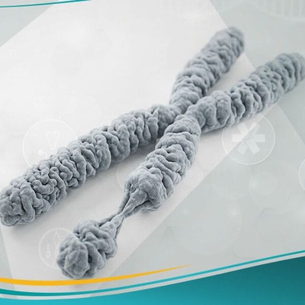 متلازمة كروموزوم إكس الهش