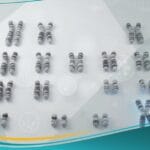 _متلازمة كلاينفلتر (1)