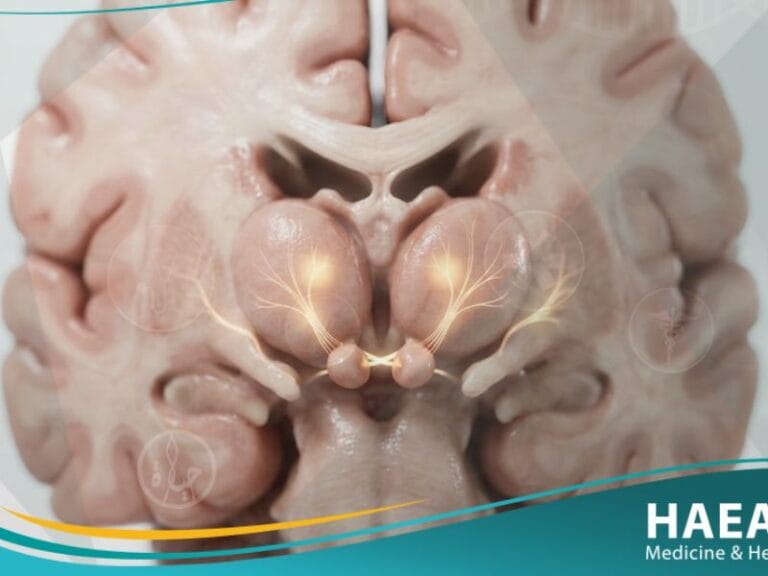 متلازمة كورساكوف