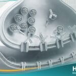 متلازمة لامبرت إيتون