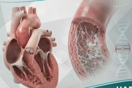 متلازمة مارفان (1)
