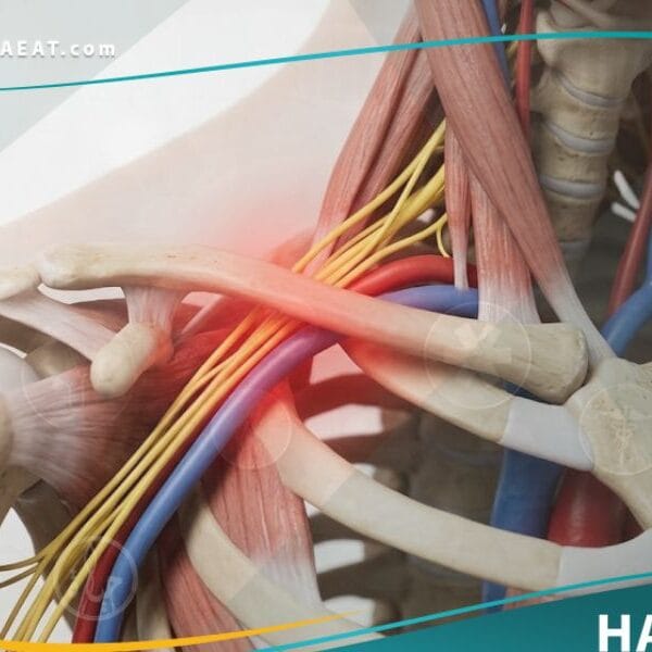 _متلازمة مخرج الصدر