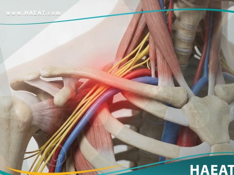 _متلازمة مخرج الصدر