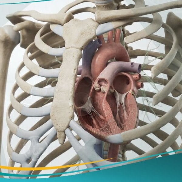 متلازمة نونان