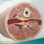 _مرض الأوعية الدموية المحيطية