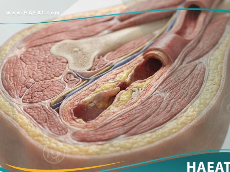 _مرض الاوعية الدموية المحيطية