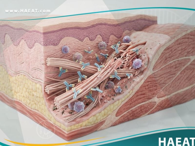 _مرض النسيج الضام المختلط