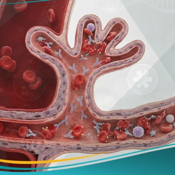 مرض انحلال الدم الوليدي