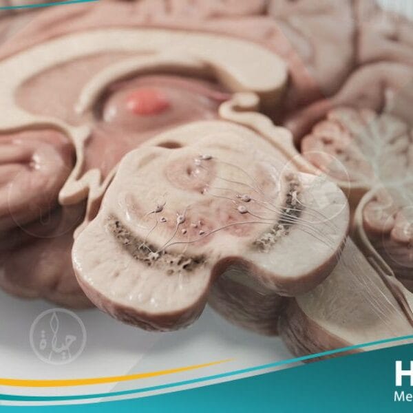 مرض باركنسون (2)