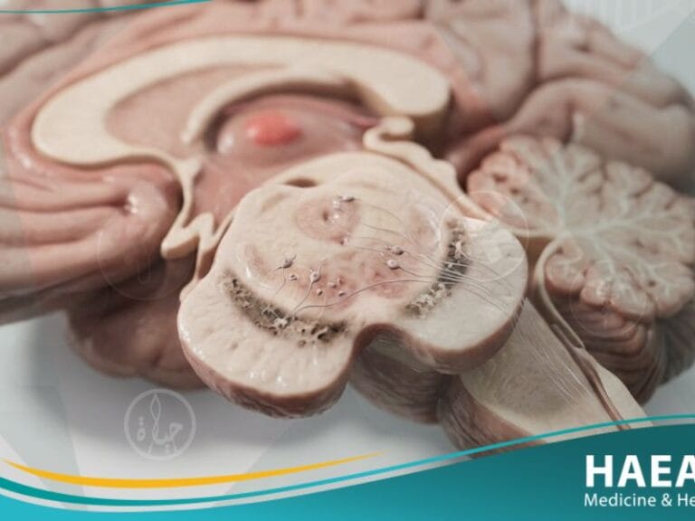 مرض باركنسون (2)