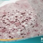 _مرض جنون البقر