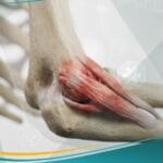 مرفق لاعب التنس