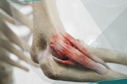 مرفق لاعب التنس