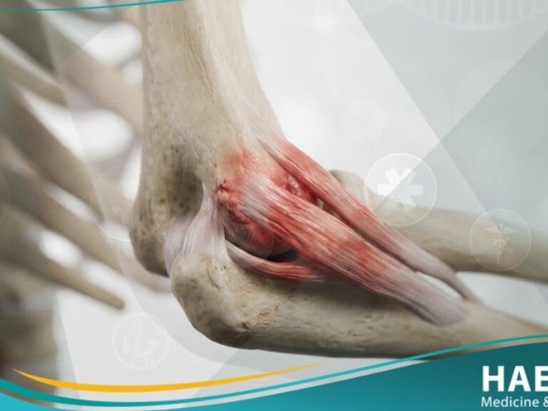 مرفق لاعب التنس