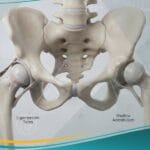 _مفصل الورك