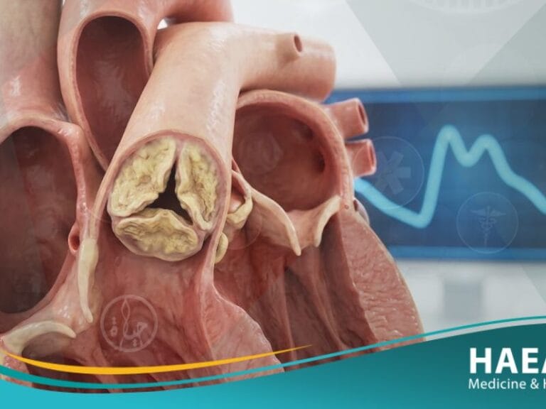 نبض مثلوم الصاعدة