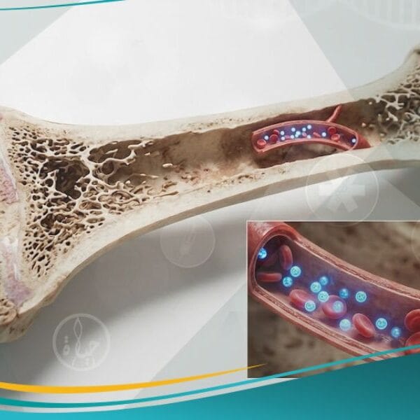 نقص الكالسيوم عند الاطفال