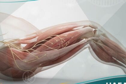 نقص توتر العضلات