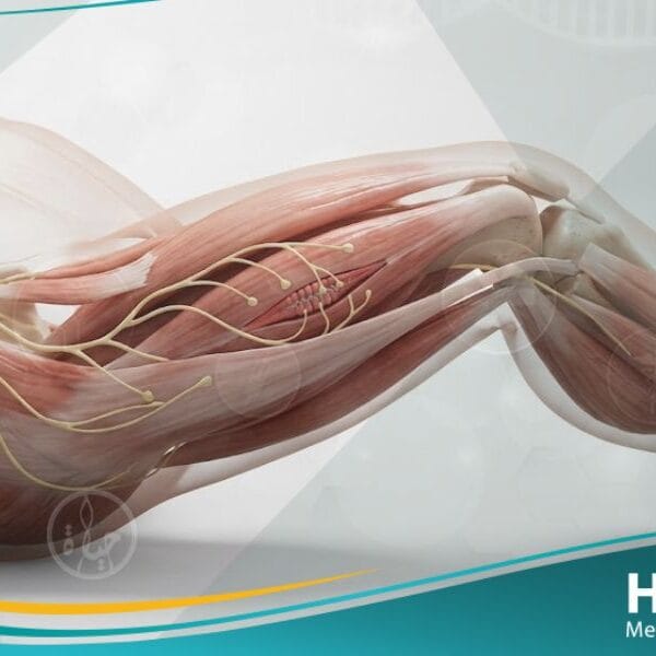 نقص توتر العضلات