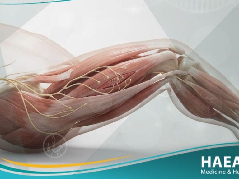 نقص توتر العضلات