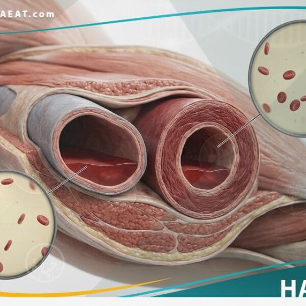 _نقص حجم الدم