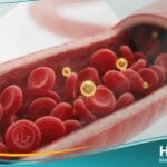 نقص سكر الدم