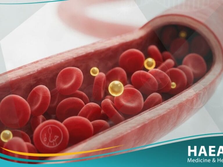 نقص سكر الدم