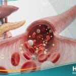 نقص سكر الدم الحاد