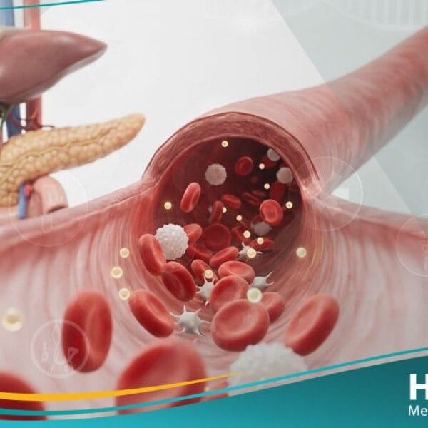 نقص سكر الدم الحاد