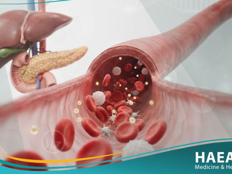 نقص سكر الدم الحاد