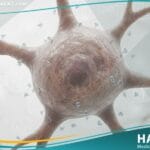 نقص صوديوم الدم (3)