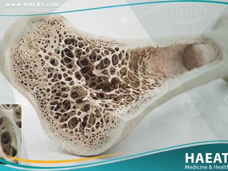 نقص فيتامين د