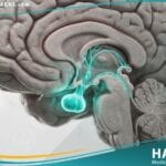 _نقص هرمون النمو