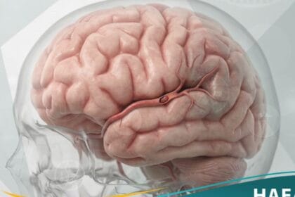 نوبة إقفارية عابرة