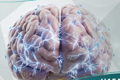 نوبة توترية رمعية