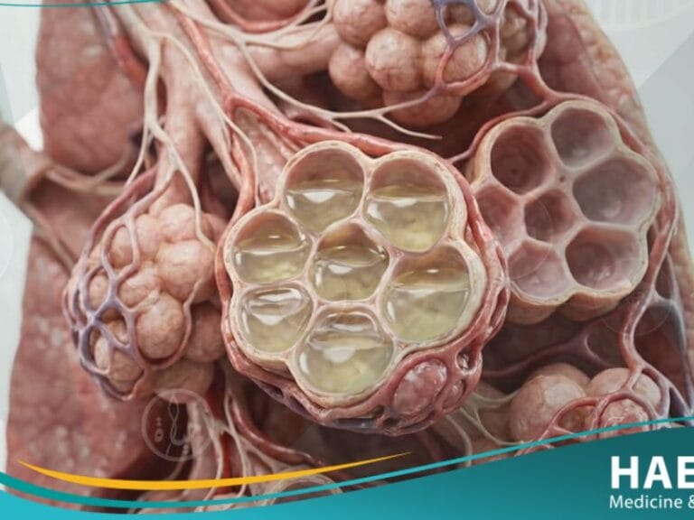 _وذمة الرئة