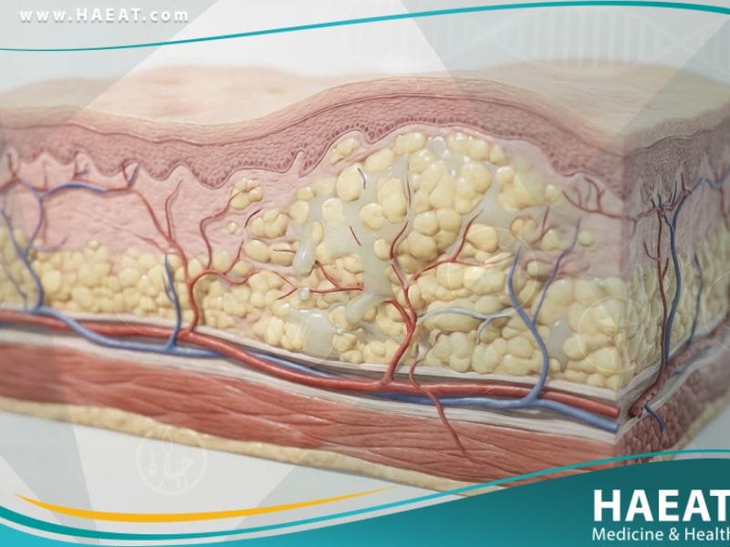 وذمة وعائية عصبية وراثية