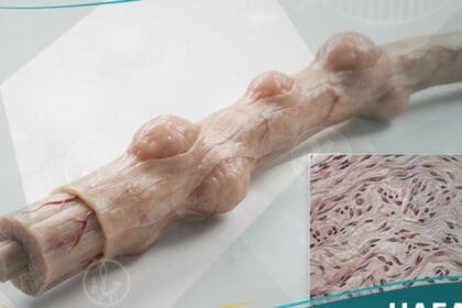 ورام ليفي عصبي