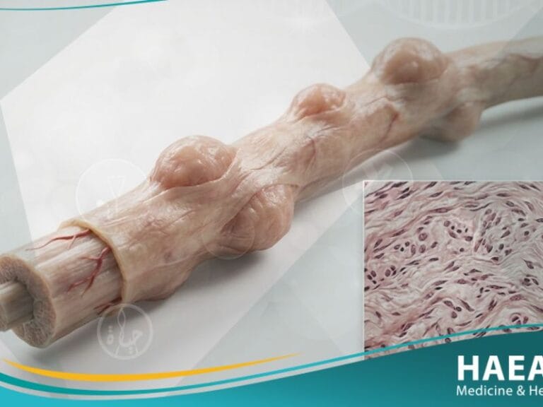 ورام ليفي عصبي