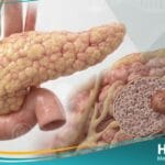 ورم إنسوليني