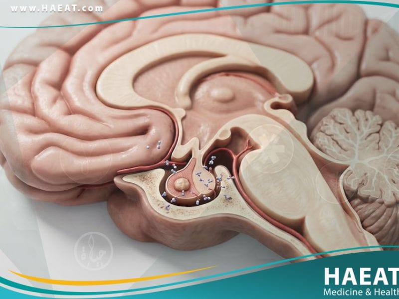 ورم برولاكتيني